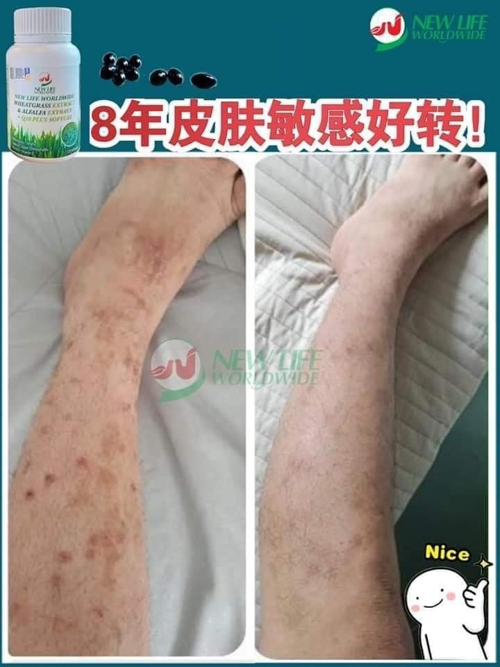 共用圖片/檔案 - allergy